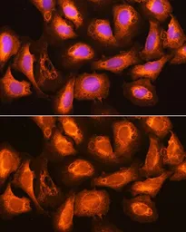 Anti-SEC11A antibody used in Immunocytochemistry/ Immunofluorescence (ICC/IF). GTX66062