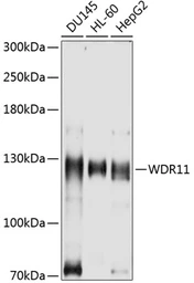 Anti-WDR11 antibody used in Western Blot (WB). GTX66063