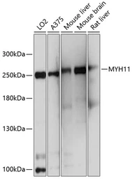 Anti-Myosin Heavy Chain 11 antibody used in Western Blot (WB). GTX66065