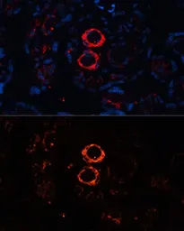 Anti-Myosin Heavy Chain 11 antibody used in IHC (Paraffin sections) (IHC-P). GTX66065