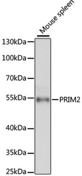Anti-PRIM2 antibody used in Western Blot (WB). GTX66076