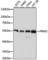Anti-PRIM2 antibody used in Western Blot (WB). GTX66076