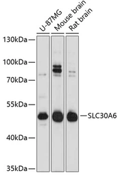 Anti-SLC30A6 antibody used in Western Blot (WB). GTX66077