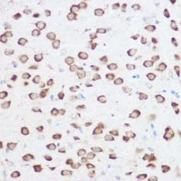 Anti-RPS24 antibody used in Immunoprecipitation (IP). GTX66088