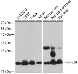 Anti-RPS24 antibody used in Western Blot (WB). GTX66088