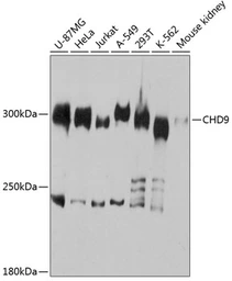 Anti-CHD9 antibody used in Western Blot (WB). GTX66089