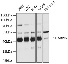Anti-SHARPIN antibody used in Western Blot (WB). GTX66093