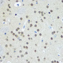 Anti-UBE1 antibody used in IHC (Paraffin sections) (IHC-P). GTX66102
