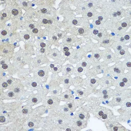 Anti-UBE1 antibody used in IHC (Paraffin sections) (IHC-P). GTX66102
