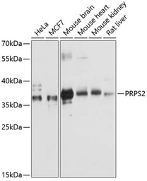 Anti-PRPS2 antibody used in Western Blot (WB). GTX66111