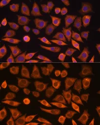 Anti-GUCY1A3 antibody used in Immunocytochemistry/ Immunofluorescence (ICC/IF). GTX66113