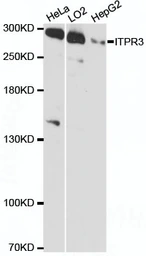 Anti-ITPR3 antibody used in Western Blot (WB). GTX66117