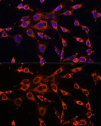 Anti-ITPR3 antibody used in Immunocytochemistry/ Immunofluorescence (ICC/IF). GTX66117