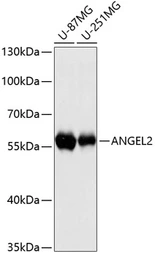 Anti-ANGEL2 antibody used in Western Blot (WB). GTX66118
