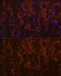 Anti-SNX13 antibody used in IHC (Paraffin sections) (IHC-P). GTX66121