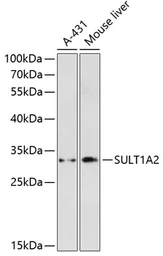 Anti-SULT1A2 antibody used in Western Blot (WB). GTX66128