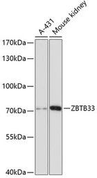 Anti-Kaiso antibody used in Western Blot (WB). GTX66129