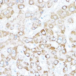 Anti-Kaiso antibody used in IHC (Paraffin sections) (IHC-P). GTX66129