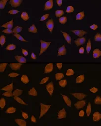 Anti-CRYZ antibody used in Immunocytochemistry/ Immunofluorescence (ICC/IF). GTX66130