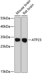 Anti-XRCC6BP1 antibody used in Western Blot (WB). GTX66132