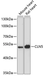 Anti-CLN5 antibody used in Western Blot (WB). GTX66133