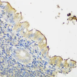 Anti-CLN5 antibody used in IHC (Paraffin sections) (IHC-P). GTX66133
