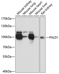 Anti-PALD1 antibody used in Western Blot (WB). GTX66135