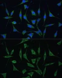 Anti-PALD1 antibody used in Immunocytochemistry/ Immunofluorescence (ICC/IF). GTX66135