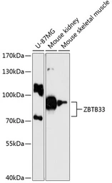 Anti-Kaiso antibody used in Western Blot (WB). GTX66136