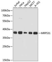 Anti-MRPS31 antibody used in Western Blot (WB). GTX66138
