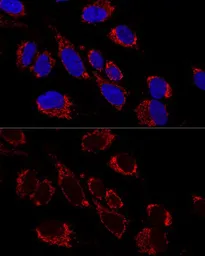 Anti-MRPS31 antibody used in Immunocytochemistry/ Immunofluorescence (ICC/IF). GTX66138