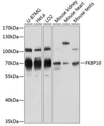 Anti-FKBP10 antibody used in Western Blot (WB). GTX66140