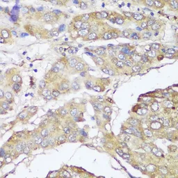 Anti-FKBP10 antibody used in IHC (Paraffin sections) (IHC-P). GTX66140