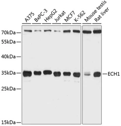 Anti-ECH1 antibody used in Western Blot (WB). GTX66141