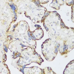 Anti-ECH1 antibody used in IHC (Paraffin sections) (IHC-P). GTX66141