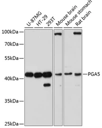 Anti-PGA5 antibody used in Western Blot (WB). GTX66144