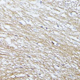 Anti-SEPT5 antibody used in IHC (Paraffin sections) (IHC-P). GTX66146