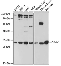 Anti-SFXN1 antibody used in Western Blot (WB). GTX66147