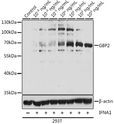 Anti-GBP2 antibody used in Western Blot (WB). GTX66148