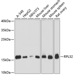 Anti-RPL32 antibody used in Western Blot (WB). GTX66149