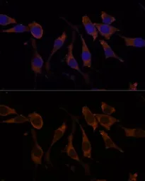 Anti-RPL32 antibody used in Immunocytochemistry/ Immunofluorescence (ICC/IF). GTX66149