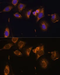 Anti-RPL32 antibody used in Immunocytochemistry/ Immunofluorescence (ICC/IF). GTX66149