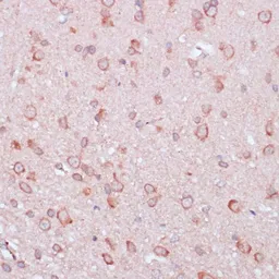 Anti-RPL32 antibody used in IHC (Paraffin sections) (IHC-P). GTX66149