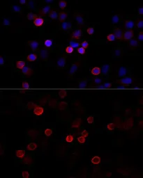 Anti-FLNC antibody used in Immunocytochemistry/ Immunofluorescence (ICC/IF). GTX66151