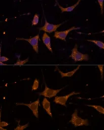 Anti-RPL27 antibody used in Immunocytochemistry/ Immunofluorescence (ICC/IF). GTX66153