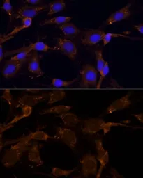 Anti-RPL27 antibody used in Immunocytochemistry/ Immunofluorescence (ICC/IF). GTX66153