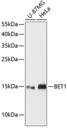 Anti-BET1 antibody used in Western Blot (WB). GTX66158