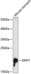 Anti-Gastrokine 1 antibody used in Western Blot (WB). GTX66162