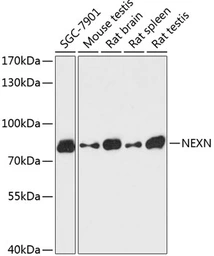 Anti-NEXN antibody used in Western Blot (WB). GTX66168