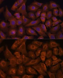Anti-NEXN antibody used in Immunocytochemistry/ Immunofluorescence (ICC/IF). GTX66168